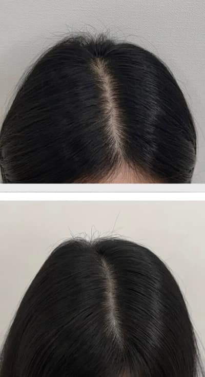 [경북 포항시] 포항두피문신톤오브 뷰티샵 체험단