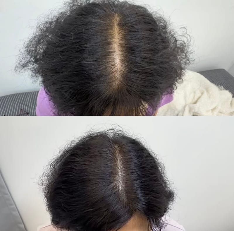 [경북 포항시] 포항두피문신톤오브 뷰티샵 체험단