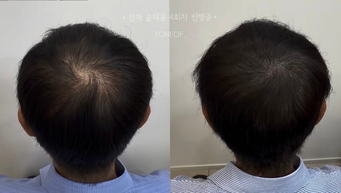 [경북 포항시] 포항두피문신톤오브 뷰티샵 체험단