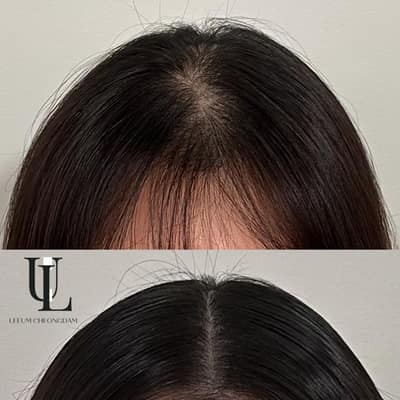 [서울 강남] 더 리움(The Leeum)