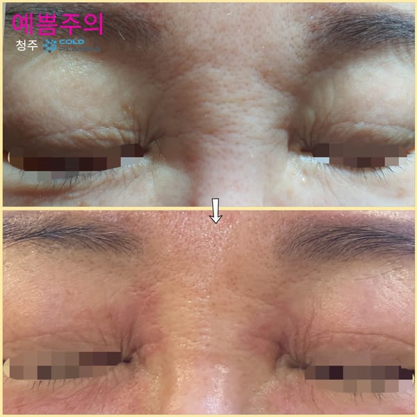 [청주] 예쁨주의
