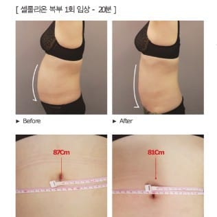 [부산] 에스테틱힐링수