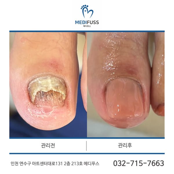 [인천 연수구] 메디푸스